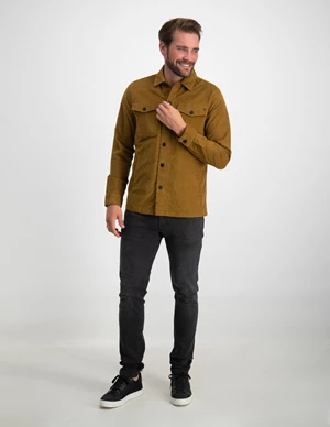 No Excess Overshirt Button Closure Structure 21530826